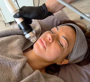 Bio-Microneedling bei Hautgefühl